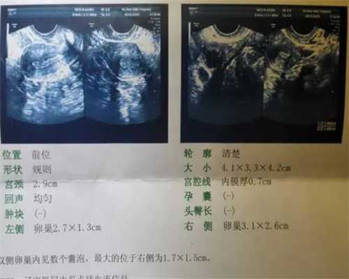 广州权威代生公司,2023
做试管婴儿可以用医保吗？广州能不能报销？-抽血可以