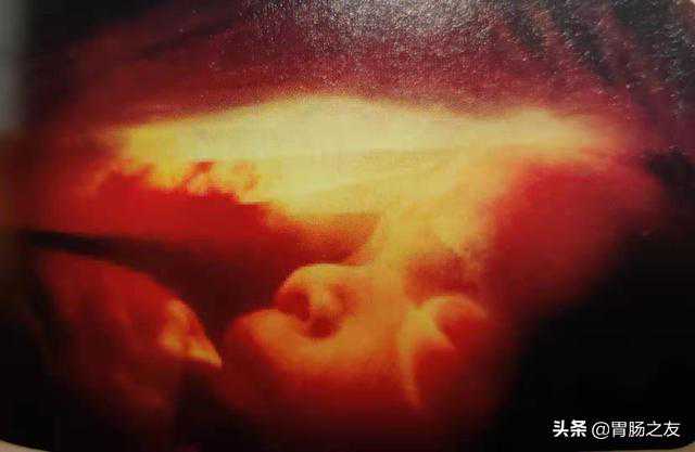 想知道十月怀胎的过程吗？九幅图为您展示胎儿在子宫内的样子