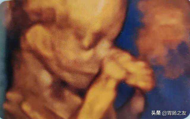 想知道十月怀胎的过程吗？九幅图为您展示胎儿在子宫内的样子