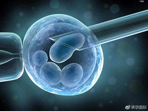 你适合哪种美国试管婴儿方案冷冻胚胎移植还是新鲜胚胎移植