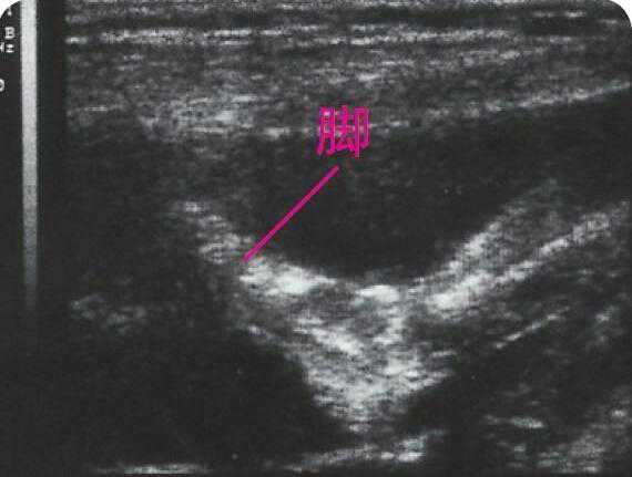 怀孕1~9个月，通过B超看胎儿慢慢长大的样子，真是太神奇了